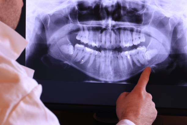 Best Walk-In Emergency Dentist in Middletown, IN
