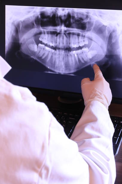 Best Emergency Tooth Extraction in Middletown, IN